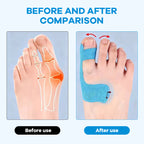 Pre-cut kinesiology tape for bunion correction