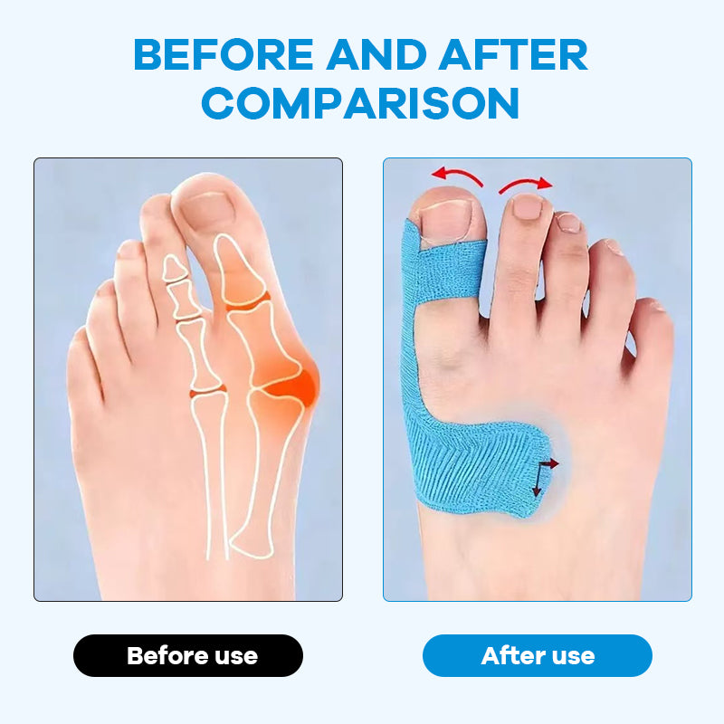 Pre-cut kinesiology tape for bunion correction